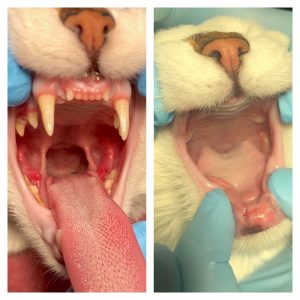 pre and post stomatitis collage 300x300 - Stomatitis